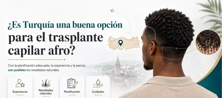 ¿Es Turquía una buena opción para el trasplante de cabello afro?