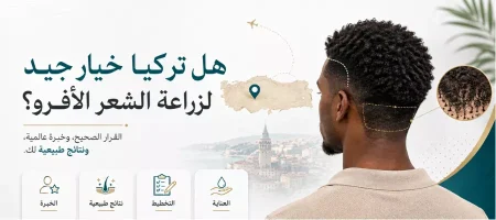هل تركيا خيار جيد لزراعة الشعر الأفريقي؟