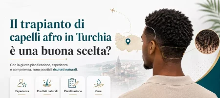 La Turchia è una buona opzione per il trapianto di capelli afro?