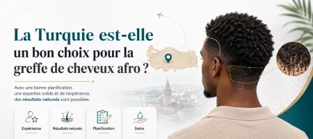 La Turquie est-elle une bonne option pour une greffe de cheveux afro ?