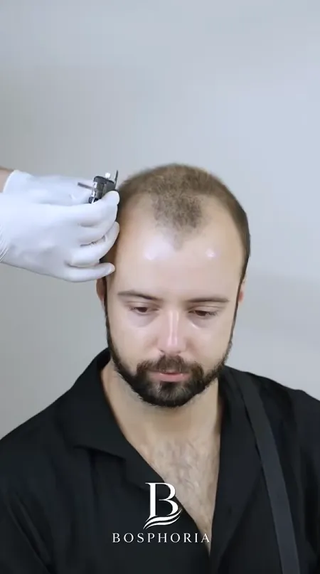 img-video