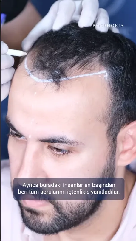 img-video